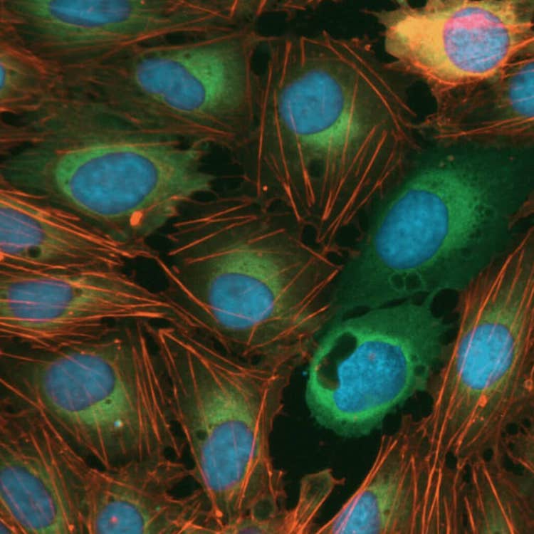세포의 Morphology 디스럽터, ImageXpress Nano 시스템을 이용한 획득