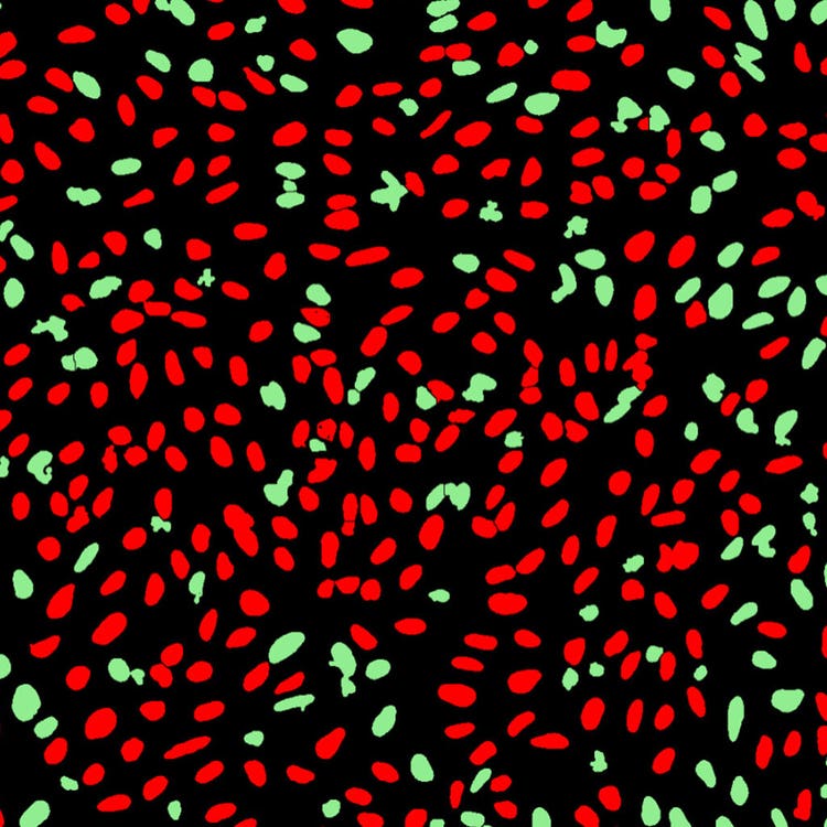 ImageXpress Nano 시스템을 이용한 U2OS 세포의 DNA 손상 마스크