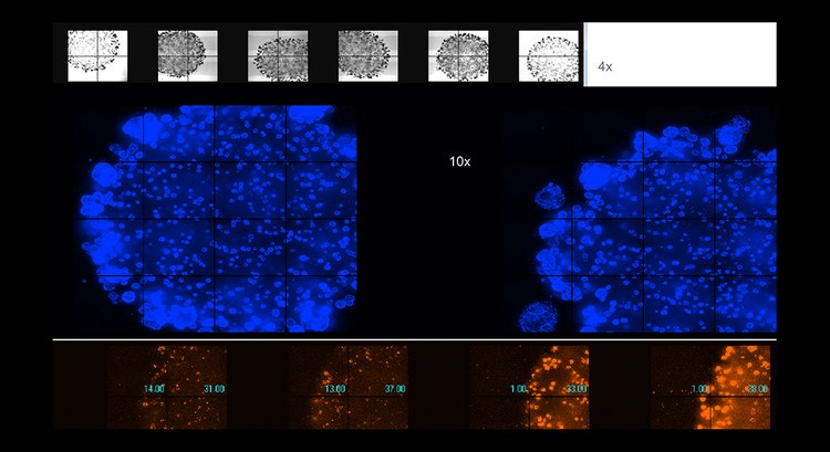 ImageXpress Nano 시스템을 이용한 40배로 스티치한 Neurite Tracing 마스크