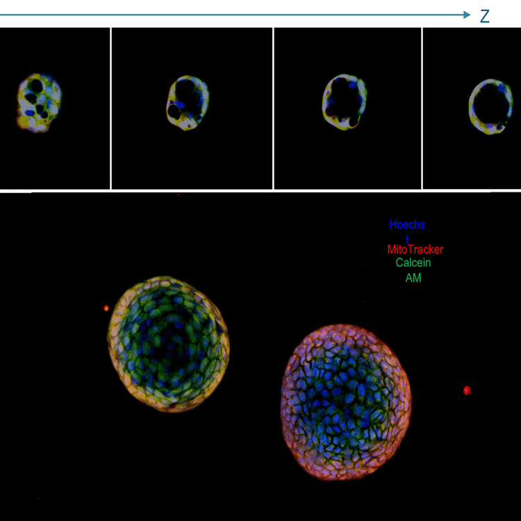 ImageXpress Nano 시스템을 이용한 U2OS 세포의 DNA 손상 오버레이