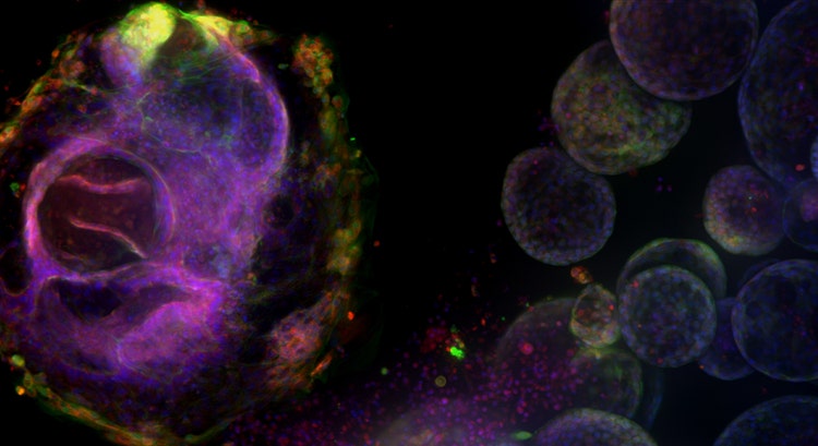 세포의 Morphology 디스럽터, ImageXpress Nano 시스템을 이용한 획득