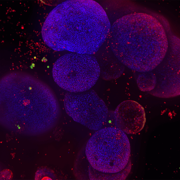 ImageXpress Nano 시스템을 이용한 U2OS 세포의 DNA 손상 마스크