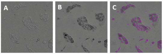 Images of unstained MDCK cells in transmitted light