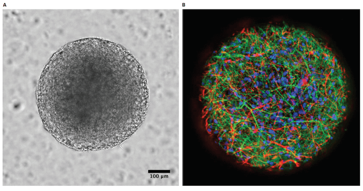 Brightfield and immunostained StemoniX microBrain 3D spheroids