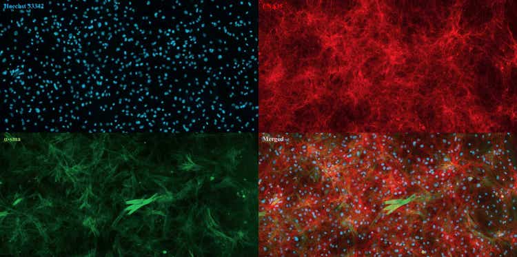 소 피부에서 분리하여 배양한 진피 섬유아세포의 ImageXpress Pico Automated Cell Imaging System을 사용하여 획득한 이미지 핵(Blue), 콜라겐(Red), 알파 평활근 액틴(Green)