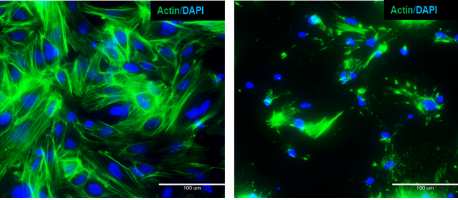 세포골격 붕괴 - 비처리 및 라트룬쿨린 처리 세포를 액틴으로 염색한 iPSC 유래 간세포