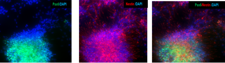 iPSCs 유래 신경 전구 세포는 신경 전구 표지자 PAX6 및 Nestin을 발현합니다.