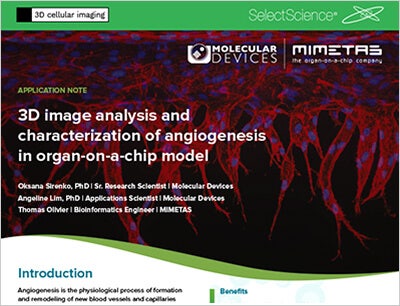 characterization of-angiogenesis-in organ-on-a-chip-model