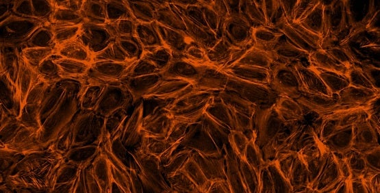 F-actin cytoskeleton