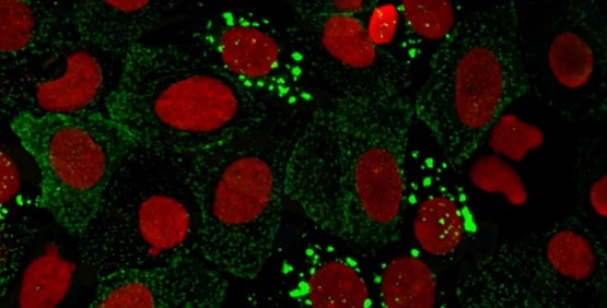 High-Content Imaging(HCI)과 High-Content Analysis(HCA)를 위한 세포 이미징 시스템