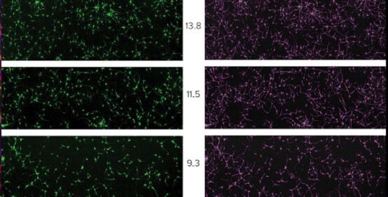 복합 Cell Based Assay를 위한 이미징 기반의 세포분석