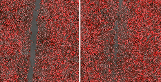 세포 Migration Assay