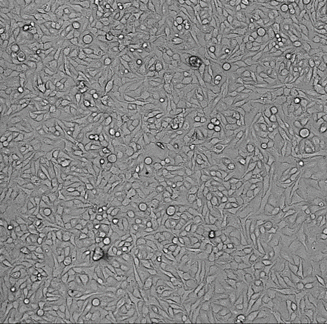 Transmitted light을 이용한 이용한 Cell Counting