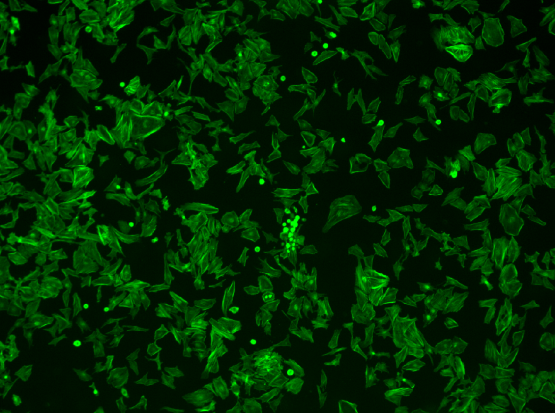 Image Cytometry Cell Counting 기법