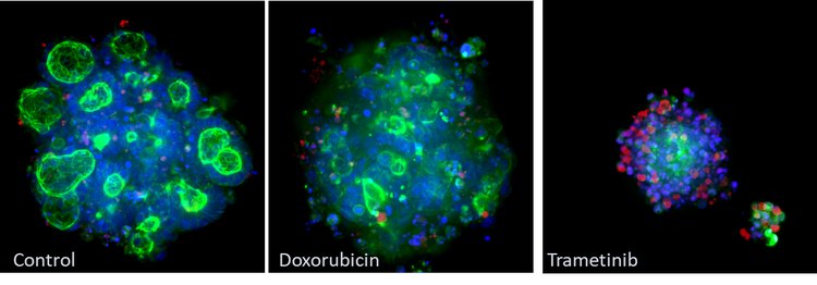 Example of morphological changes captured using ImageXpress® Micro Confocal system