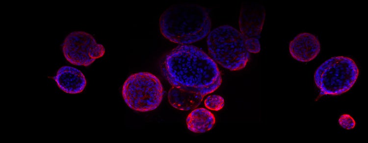 Duodenal adenoma organoids derived