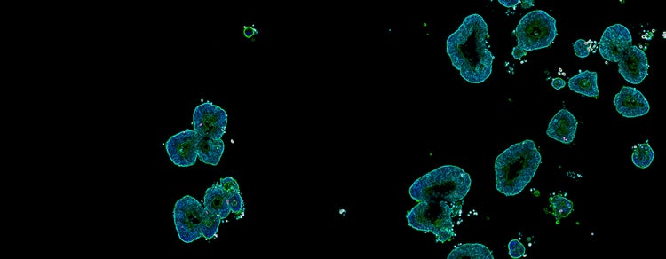 organoid production