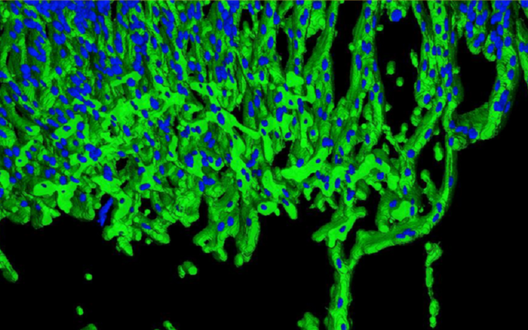 3D Analysis of Angiogenic Sprouts (green) and nuclei (blue) using MetaXpress
