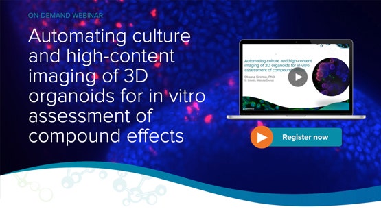 Automating Culture and High-Content Imaging of 3D Organoids
