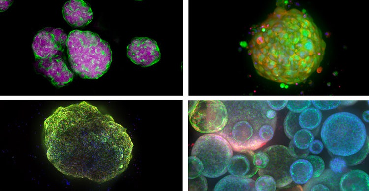 Examples of 3D cell models - Spheroids, patient-derived organoids, cardioid (heart organoid), and lung organoids