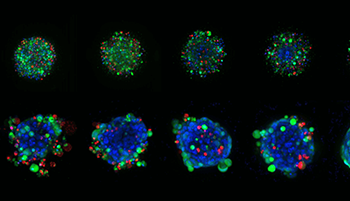 3D Cancer Cell Models