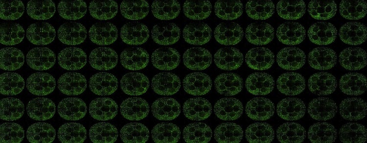 Liver-Derived Organoids