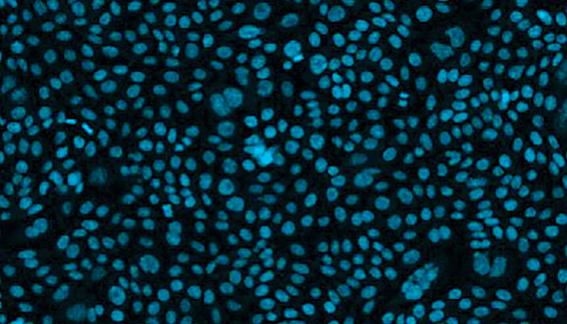 Cell line development에서 CHO 세포 역할의 진화