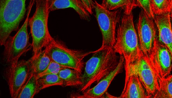 High-Content Phenotypic Screening