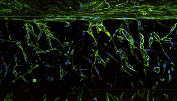 Enhancing 3D Disease Models